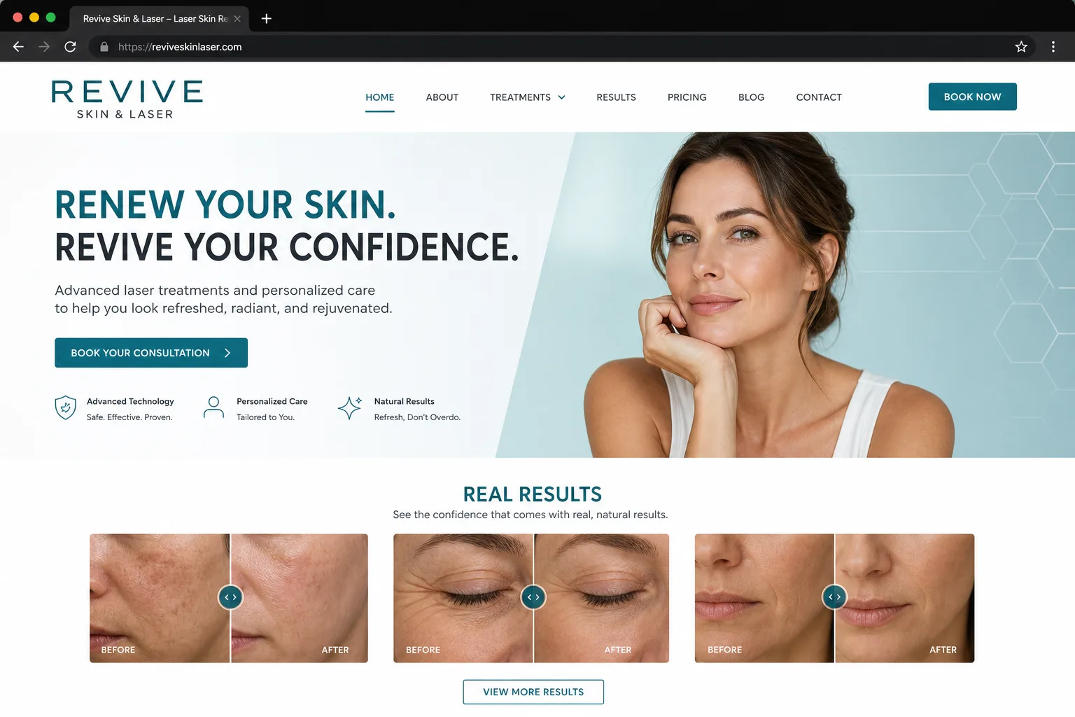 Revive Skin & Laser — website built by Arkidis